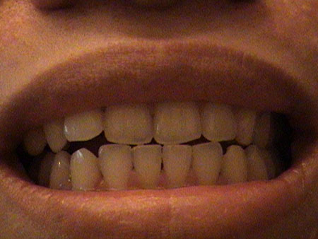 My teeth are clean now